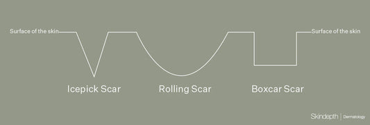 Understanding Trichloroacetic Acid: Why Dermatologists Love TCA