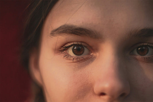 How Do I Treat Dark Circles Under the Eyes?