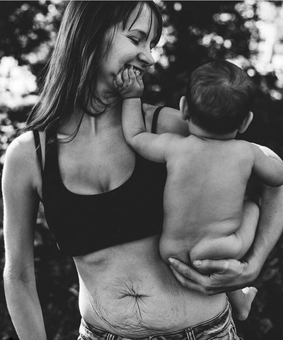 Pregnancy and Your Skin: What to Expect and How to Manage Changes