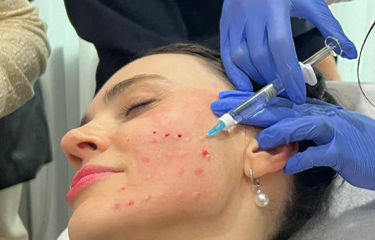 Introducing the Latest Collagen Promoting Injectable to Skindepth, Rejuran