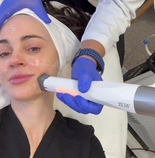 XERF Treatment: Advanced RF Skin Tightening in Australia