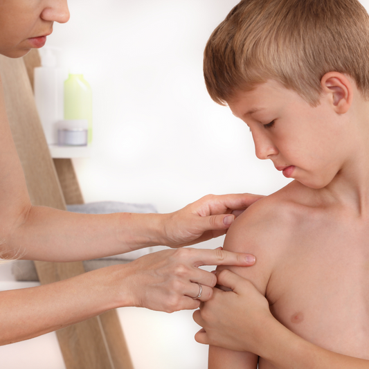 When should kids start getting skin checks?