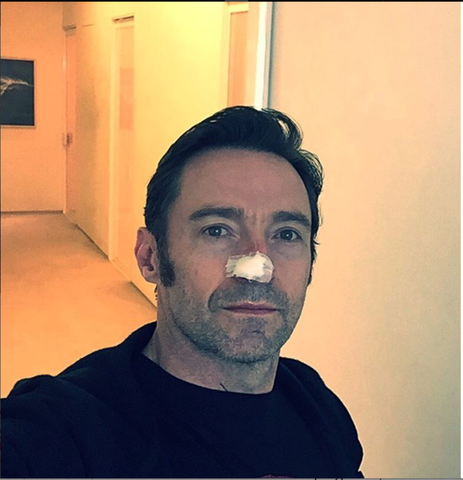 Even Celebrities Get Skin Cancer!