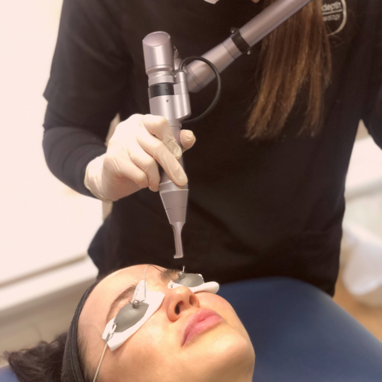 Does laser hurt? Skindepth AU