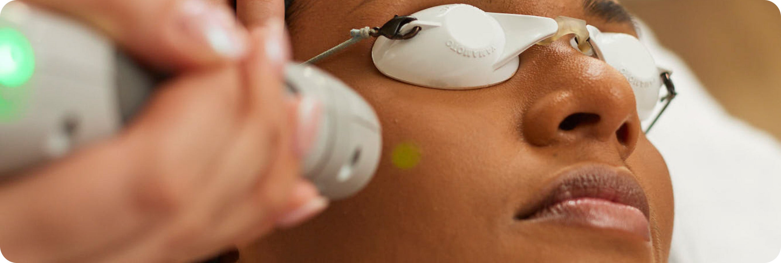 files/Skindepth_Derma_Expess_laser_facial.jpg